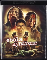 伊波拉病毒 Ebola Syndrome