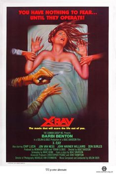 X-Ray (1982)