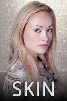Skin (2003-2005)